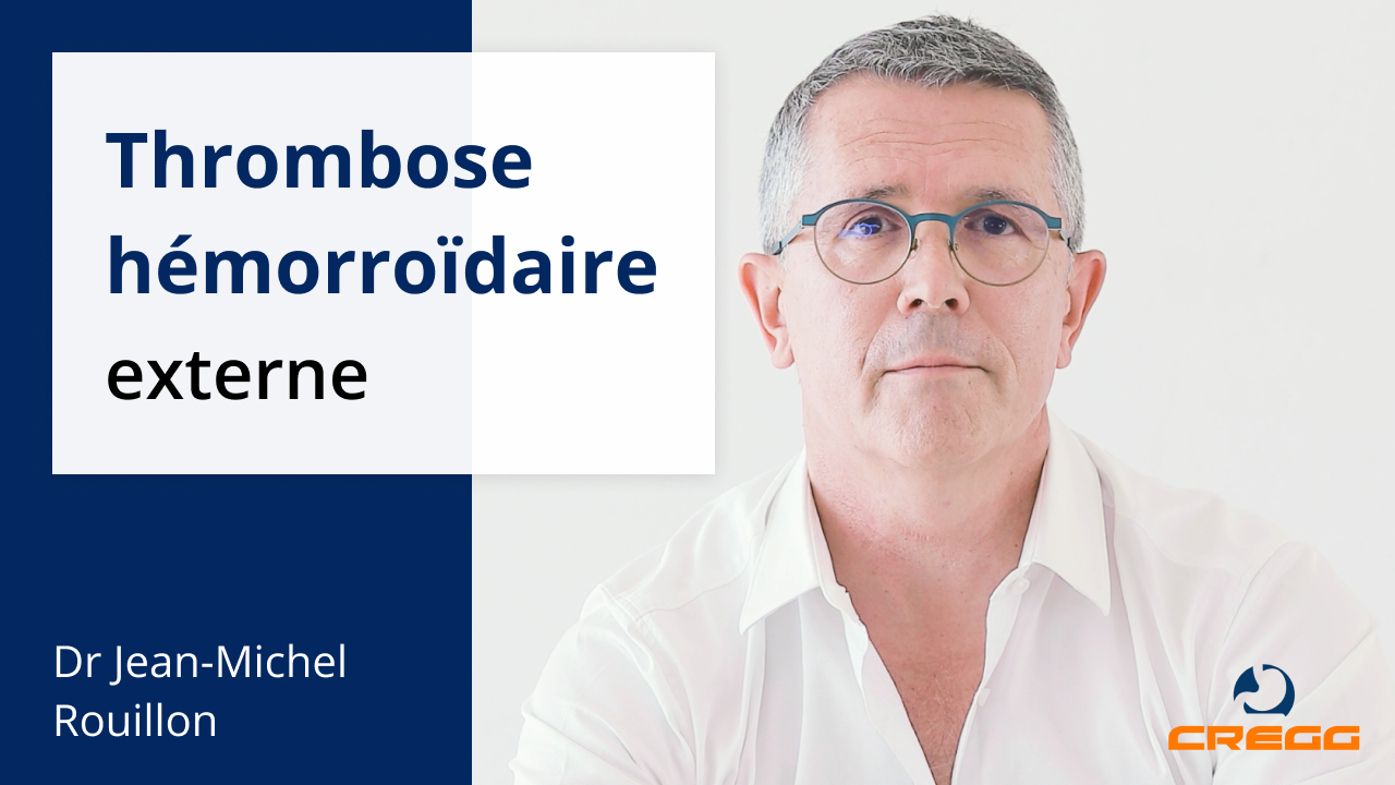 Thrombose hémorroïdaire externe - Explication du Dr. Jean-Michel Rouillon